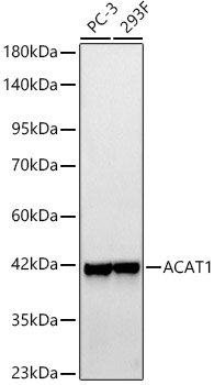 Western blot analysis of various lysates, using ACAT1 Rabbit mAb at 1:9000 dilution.|Secondary antibody: HRP-conjugated Goat anti-Rabbit IgG (H+L) at 1:10000 dilution.|Lysates/proteins: 25μg per lane.|Blocking buffer: 3% nonfat dry milk in TBST.|Detection: ECL Basic Kit.|Exposure time: 10s.