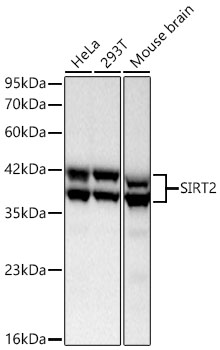 Western blot analysis of various lysates using SIRT2 Rabbit mAb at 1:6400 dilution incubated overnight at 4℃.|Secondary antibody: HRP-conjugated Goat anti-Rabbit IgG (H+L) at 1:10000 dilution.|Lysates/proteins: 25 μg per lane.|Blocking buffer: 3% nonfat dry milk in TBST.|Detection: ECL Basic Kit.|Exposure time: 30s.