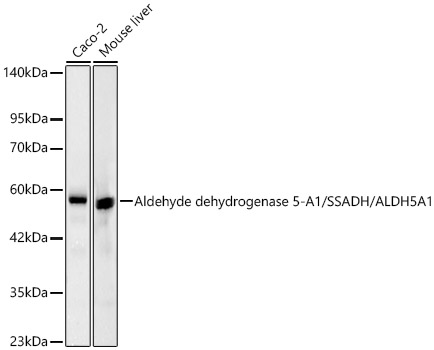 Western blot analysis of various lysates, using Aldehyde dehydrogenase 5-A1/SSADH/ALDH5A1  Rabbit mAb at 1:2000 dilution.|Secondary antibody: HRP-conjugated Goat anti-Rabbit IgG (H+L) at 1:10000 dilution.|Lysates/proteins: 25μg per lane.|Blocking buffer: 3% nonfat dry milk in TBST.|Detection: ECL Basic Kit.|Exposure time: 20s.