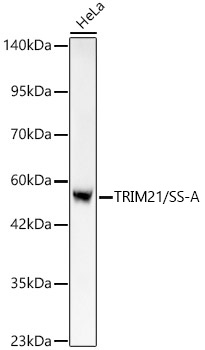 Western blot analysis of lysates from HeLa cells using [KO Validated] TRIM21/SS-A Rabbit mAb at 1:1000 dilution incubated overnight at 4℃.|Secondary antibody: HRP-conjugated Goat anti-Rabbit IgG (H+L) at 1:10000 dilution.|Lysates/proteins: 25 μg per lane.|Blocking buffer: 3% nonfat dry milk in TBST.|Detection: ECL Basic Kit.|Exposure time: 45 s.