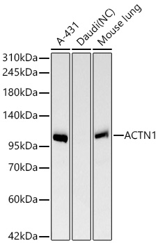 Western blot analysis of various lysates using ACTN1 Rabbit mAb at 1:3000 dilution incubated overnight at 4℃.|Secondary antibody: HRP-conjugated Goat anti-Rabbit IgG (H+L) at 1:10000 dilution.|Lysates/proteins: 25 μg per lane.|Blocking buffer: 3% nonfat dry milk in TBST.|Detection: ECL Basic Kit.|Negative control (NC): Daudi|Exposure time: 60s.