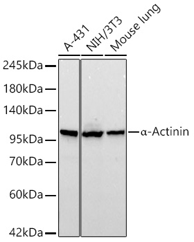 Western blot analysis of various lysates using α-Actinin Rabbit mAb (A25811)at 1:2900 dilution incubated overnight at 4℃.|Secondary antibody: HRP-conjugated Goat anti-Rabbit IgG (H+L) (AS014) at 1:10000 dilution.|Lysates/proteins: 25 μg per lane.|Blocking buffer: 3% nonfat dry milk in TBST.|Detection: ECL Basic Kit (RM00020).|Exposure time: 90s.