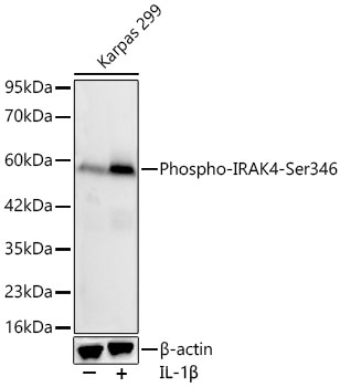 Western blot analysis of lysates from Karpas 299 cells using Phospho-IRAK4-Ser346 Rabbit mAb at 1:1000 dilution. Karpas 299 cells were treated with IL-1β (200 ng/ml) at 37℃ for 15 minutes after serum starvation overnight.|Secondary antibody: HRP-conjugated Goat anti-Rabbit IgG (H+L) at 1:10000 dilution.|Lysates/proteins: 25 μg per lane.|Blocking buffer: 3% nonfat dry milk in TBST.|Detection: ECL Basic Kit.|Exposure time: 75s.
