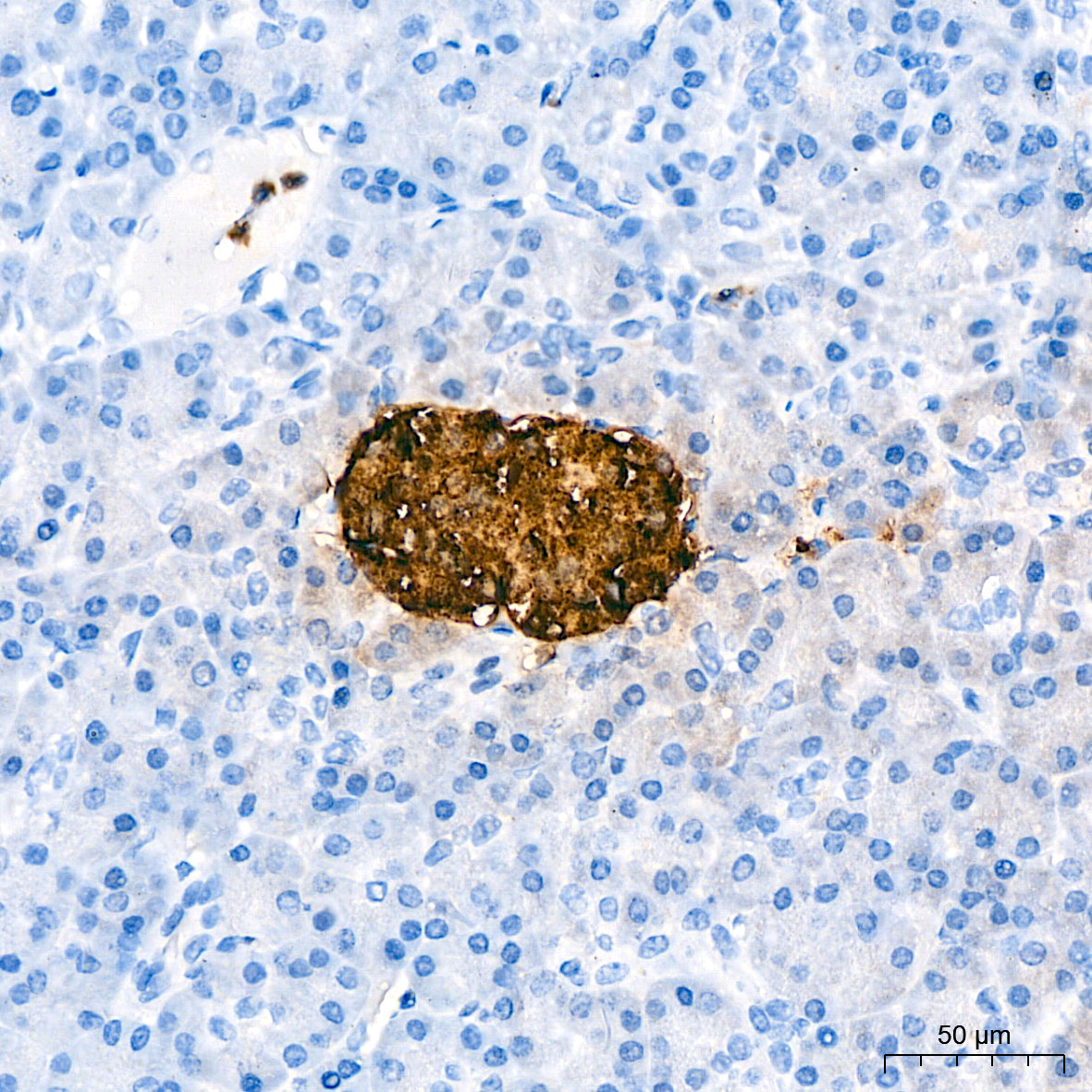 Immunohistochemistry analysis of paraffin-embedded Human pancreas tissue using C-Peptide Rabbit mAb at a dilution of 1:30000 (40x lens). High pressure antigen retrieval performed with 0.01M Citrate Buffer (pH 6.0) prior to IHC staining.
