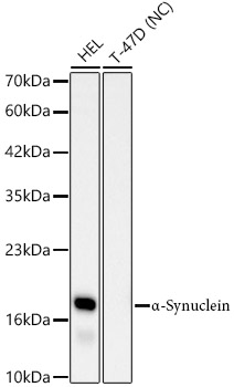 Western blot analysis of various lysates using α-Synuclein Rabbit mAb (A24951) at 1:7000 dilution.|Secondary antibody: HRP-conjugated Goat anti-Rabbit IgG (H+L) (AS014) at 1:10000 dilution.|Lysates/proteins: 25μg per lane.|Blocking buffer: 3% nonfat dry milk in TBST.|Detection: ECL Basic Kit (RM00020).|Negative control (NC): T-47D|Exposure time: 90s.