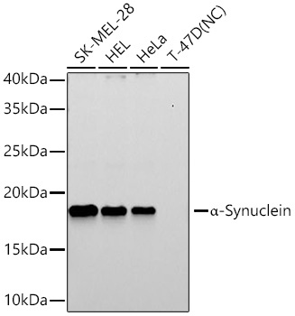 Western blot analysis of various lysates using α-Synuclein Rabbit mAb at 1:7000 dilution incubated overnight at 4℃.|Secondary antibody: HRP-conjugated Goat anti-Rabbit IgG (H+L) at 1:10000 dilution.|Lysates/proteins: 25 μg per lane.|Blocking buffer: 3% nonfat dry milk in TBST.|Detection: ECL Basic Kit.|Negative control (NC): T-47D|Exposure time: 90s.
