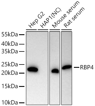 Western blot analysis of various lysates using RBP4 Rabbit mAb at 1:5000 dilution incubated at room temperature for 1.5 hours.|Secondary antibody: HRP-conjugated Goat anti-Rabbit IgG (H+L) at 1:10000 dilution.|Lysates/proteins: 25 μg per lane.|Blocking buffer: 3% nonfat dry milk in TBST.|Detection: ECL Basic Kit.|Negative control (NC): HAP1|Exposure time: 90s.
