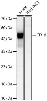 Western blot analysis of various lysates using CD1d Rabbit mAb at 1:1000 dilution.|Secondary antibody: HRP-conjugated Goat anti-Rabbit IgG (H+L) at 1:10000 dilution.|Lysates/proteins: 25 μg per lane.|Blocking buffer: 3% nonfat dry milk in TBST.|Detection: ECL Basic Kit.|Negative control (NC): REH.|Exposure time: 45s.