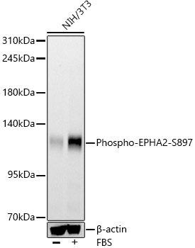 Western blot analysis of lysates from NIH/3T3 cells using Phospho-EPHA2-S897 at 1:1000 dilution. NIH/3T3 cells were treated with 10% FBS at 37℃ for 5 minutes after serum-starvation overnight.|Secondary antibody: HRP-conjugated Goat anti-Rabbit IgG (H+L) at 1:10000 dilution.|Lysates/proteins: 25 μg per lane.|Blocking buffer: 3% nonfat dry milk in TBST.|Detection: ECL Basic Kit.|Exposure time: 90 s.