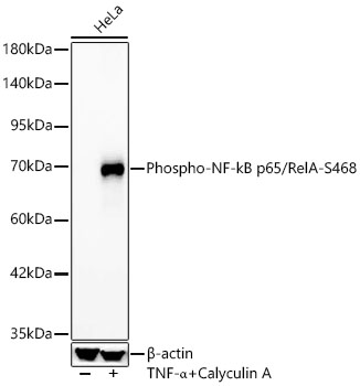 Western blot analysis of lysates from HeLa cells using Phospho-NF-kB p65/RelA-S468 Rabbit mAb at 1:2000 dilution. HeLa cells were treated with TNF-α (20 ng/ml) and Calyculin A (100 nM) at 37℃ for 10 minutes.|Secondary antibody: HRP-conjugated Goat anti-Rabbit IgG (H+L) at 1:10000 dilution.|Lysates/proteins: 25 μg per lane.|Blocking buffer: 3% nonfat dry milk in TBST.|Detection: ECL Basic Kit.|Exposure time: 30s.