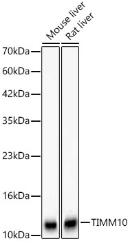 Western blot analysis of various lysates using [KD Validated] TIMM10 Rabbit mAb (A24996) at 1:6000 dilution.|Secondary antibody: HRP-conjugated Goat anti-Rabbit IgG (H+L) (AS014) at 1:10000 dilution.|Lysates/proteins: 25μg per lane.|Blocking buffer: 3% nonfat dry milk in TBST.|Detection: ECL Basic Kit (RM00020).|Exposure time: 30s.