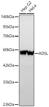 Western blot analysis of various lysates using ADSL Rabbit mAb at 1:3000 dilution incubated overnight at 4℃.|Secondary antibody: HRP-conjugated Goat anti-Rabbit IgG (H+L) at 1:10000 dilution.|Lysates/proteins: 25 μg per lane.|Blocking buffer: 3% nonfat dry milk in TBST.|Detection: ECL Basic Kit.|Exposure time: 60s.