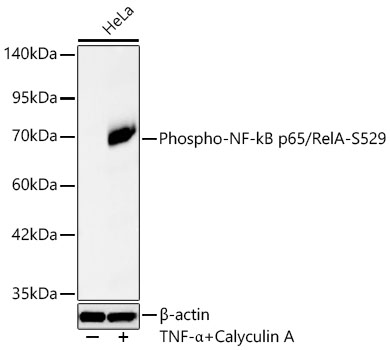 Western blot analysis of lysates from HeLa cells using Phospho-NF-kB p65/RelA-S529 Rabbit mAb at 1:1000 dilution. HeLa cells were treated with TNF-α (100 ng/ml) and Calyculin A (50 nM) at 37℃ for 30 minutes.|Secondary antibody: HRP-conjugated Goat anti-Rabbit IgG (H+L) at 1:10000 dilution.|Lysates/proteins: 45 μg per lane.|Blocking buffer: 3% nonfat dry milk in TBST.|Detection: ECL Basic Kit.|Exposure time: 45s.