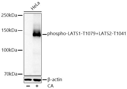 Western blot analysis of lysates from HeLa cells using phospho-LATS1-T1079+LATS2-T1041 Rabbit mAb at 1:1000 dilution incubated overnight at 4℃. HeLa cells were treated with CA (100 nM) at 37℃ for 30 minutes after serum-starvation overnight.|Secondary antibody: HRP-conjugated Goat anti-Rabbit IgG (H+L) at 1:10000 dilution.|Lysates/proteins: 25 μg per lane.| Blocking buffer: 3 % nonfat dry milk in TBST.| Detection: ECL Basic Kit.| Exposure time: 60s.