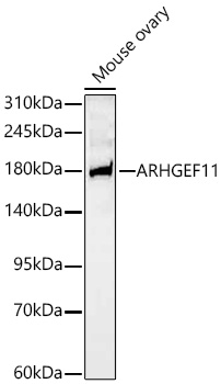 Western blot analysis of lysates from Mouse ovary using ARHGEF11 Rabbit mAb at 1:1000 dilution incubated overnight at 4℃.|Secondary antibody: HRP-conjugated Goat anti-Rabbit IgG (H+L) at 1:10000 dilution.|Lysates/proteins: 25 μg per lane.|Blocking buffer: 3% nonfat dry milk in TBST.|Detection: ECL Basic Kit.|Exposure time: 60s.