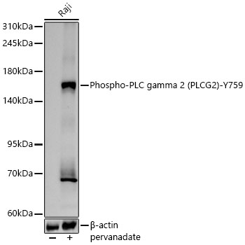 Western blot analysis of lysates from Raji cells using Phospho-PLC gamma 2 (PLCG2)-Y759 Rabbit mAb at 1:5000 dilution incubated overnight at 4°C. Raji cells were treated by Pervanadate (500 μM) at 37℃ for 30 minutes.|Secondary antibody: HRP-conjugated Goat anti-Rabbit IgG (H+L) at 1:10000 dilution.|Lysates/proteins: 25μg per lane.|Blocking buffer: 3% nonfat dry milk in TBST.|Detection: ECL Basic Kit.|Exposure time: 90s.