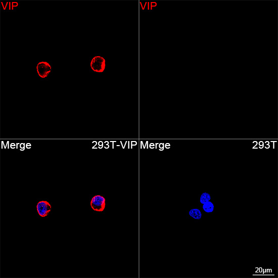 Confocal imaging of 293T cells transfected with VIP using VIP Rabbit mAb (A27070, dilution 1:200) followed by a further incubation with Cy3 Goat Anti-Rabbit IgG (H+L) (AS007, dilution 1:500) (Red). DAPI was used for nuclear staining (Blue). Objective: 100x.
