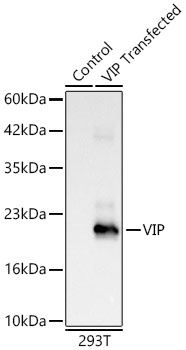 Western blot analysis of lysates from wild type (WT) and 293T cells transfected with VIP using VIP Rabbit mAb at 1:5000 dilution. |Secondary antibody: HRP-conjugated Goat anti-Rabbit IgG (H+L) at 1:10000 dilution.|Lysates/proteins: 25 μg per lane.|Blocking buffer: 3% nonfat dry milk in TBST.|Detection: ECL Basic Kit.|Exposure time: 15s.
