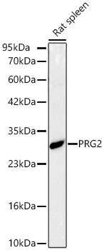 Western blot analysis of lysates from Rat spleen using PRG2 Rabbit mAb at 1:4000 dilution.|Secondary antibody: HRP-conjugated Goat anti-Rabbit IgG (H+L) at 1:10000 dilution.|Lysates/proteins: 25μg per lane.|Blocking buffer: 3% nonfat dry milk in TBST.|Detection: ECL Basic Kit.|Exposure time: 30s.