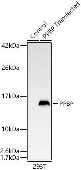 Western blot analysis of lysates from wild type (WT) and 293T cells transfected with PPBP using PPBP Rabbit mAb at 1:1000 dilution. |Secondary antibody: HRP-conjugated Goat anti-Rabbit IgG (H+L) at 1:10000 dilution.|Lysates/proteins: 25 μg per lane.|Blocking buffer: 3% nonfat dry milk in TBST.|Detection: ECL Basic Kit.|Exposure time: 45s.