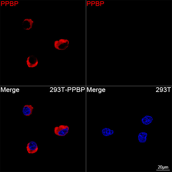 Confocal imaging of 293T cells transfected with PPBP using PPBP Rabbit mAb followed by a further incubation with Cy3 Goat Anti-Rabbit IgG (H+L) (Red). DAPI was used for nuclear staining (Blue). Objective: 100x.