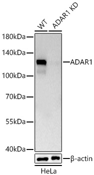 Western blot analysis of lysates from wild type (WT) and ADAR1 knockdown (KD) HeLa cells using [KD Validated] ADAR1 Rabbit mAb (A27294) at 1:5000 dilution incubated at room temperature for 1.5 hours.|Secondary antibody: HRP-conjugated Goat anti-Rabbit IgG (H+L) (AS014) at 1:10000 dilution.|Lysates/proteins: 25 μg per lane.|Blocking buffer: 3% nonfat dry milk in TBST.|Detection: ECL Basic Kit (RM00020).|Exposure time: 10s.