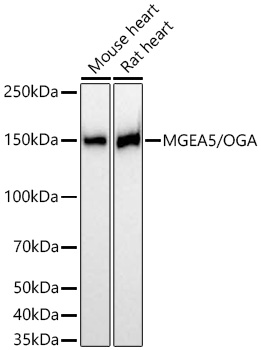 Western blot analysis of various lysates using [KD Validated] MGEA5/OGA Rabbit mAb (A24124) at 1:3000 dilution incubated overnight at 4℃.|Secondary antibody: HRP-conjugated Goat anti-Rabbit IgG (H+L) (AS014) at 1:10000 dilution.|Lysates/proteins: 25 μg per lane.|Blocking buffer: 3% nonfat dry milk in TBST.|Detection: ECL Basic Kit (RM00020).|Exposure time: 20 s.