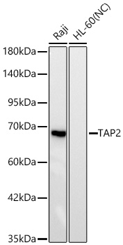 Western blot analysis of various lysates using TAP2 Rabbit mAb at 1:1000 dilution incubated overnight at 4℃.|Secondary antibody: HRP-conjugated Goat anti-Rabbit IgG (H+L) at 1:10000 dilution.|Lysates/proteins: 25 μg per lane.|Blocking buffer: 3% nonfat dry milk in TBST.|Detection: ECL Basic Kit.|Negative control (NC): HL-60|Exposure time: 30s.