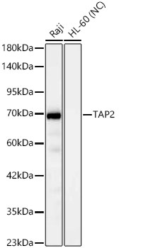 Western blot analysis of various lysates using TAP2 Rabbit mAb at 1:1000 dilution.|Secondary antibody: HRP-conjugated Goat anti-Rabbit IgG (H+L) at 1:10000 dilution.|Lysates/proteins: 25 μg per lane.|Blocking buffer: 3% nonfat dry milk in TBST.|Detection: ECL Basic Kit.|Negative control (NC): HL-60.|Exposure time: 20s.
