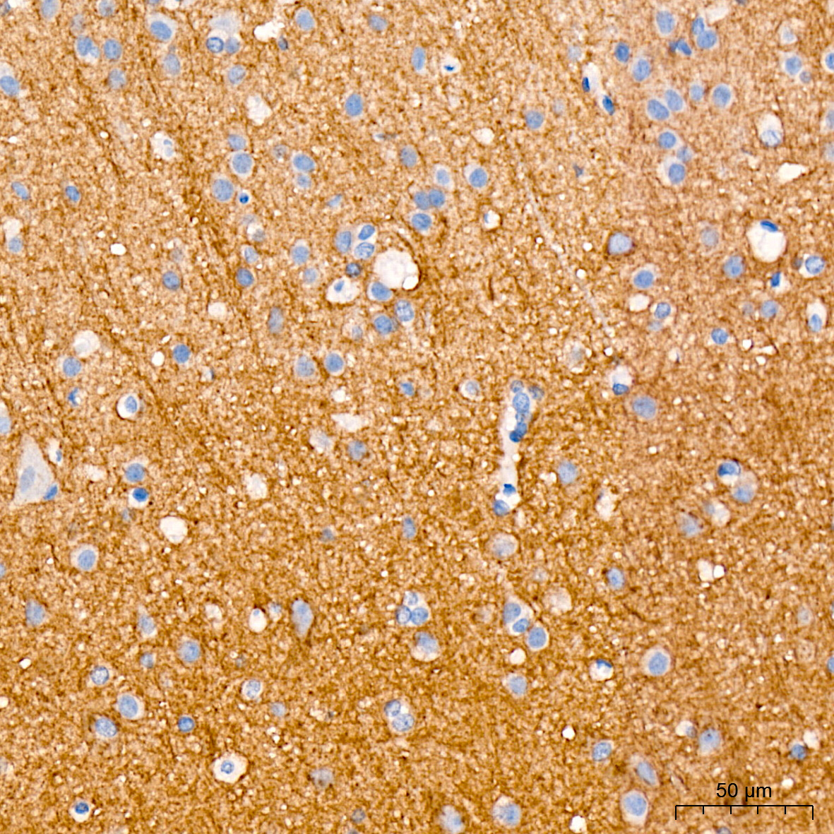 Immunohistochemistry analysis of paraffin-embedded Human brain tissue using SCN3B Rabbit mAb at a dilution of 1:200 (40x lens). High pressure antigen retrieval performed with 0.01M Citrate Buffer (pH 6.0) prior to IHC staining.