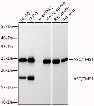 Western blot analysis of various lysates using ASC/TMS1 Rabbit mAb at 1:3000 dilution incubated overnight at 4℃.|Secondary antibody: HRP-conjugated Goat anti-Rabbit IgG (H+L) at 1:10000 dilution.|Lysates/proteins: 25 μg per lane.|Blocking buffer: 3% nonfat dry milk in TBST.|Detection: ECL Basic Kit.|Negative control (NC): Jurkat|Exposure time: 30s.