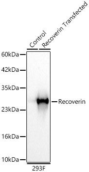 Western blot analysis of lysates from wild type (WT) and 293F cells transfected with Recoverin using Recoverin Rabbit mAb at 1:10000 dilution. |Secondary antibody: HRP-conjugated Goat anti-Rabbit IgG (H+L) at 1:10000 dilution.|Lysates/proteins: 25 μg per lane.|Blocking buffer: 3% nonfat dry milk in TBST.|Detection: ECL Basic Kit.|Exposure time: 1 s.