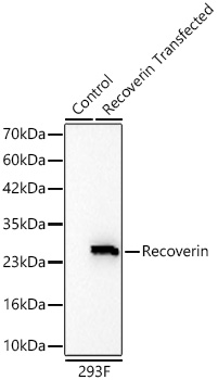 Western blot analysis of lysates from wild type (WT) and 293F cells transfected with Recoverin  using Recoverin Rabbit mAb at 1:2000 dilution incubated overnight at 4℃.|Secondary antibody: HRP-conjugated Goat anti-Rabbit IgG (H+L) at 1:10000 dilution.|Lysates/proteins: 20 μg per lane.|Blocking buffer: 3% nonfat dry milk in TBST.|Detection: ECL Basic Kit|.Exposure time: 30s.