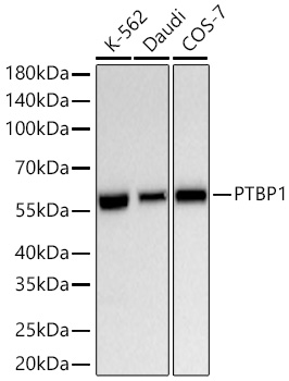 Western blot analysis of various lysates using [KD Validated] PTBP1 Rabbit mAb (A25184) at 1:6000 dilution incubated overnight at 4℃.|Secondary antibody: HRP-conjugated Goat anti-Rabbit IgG (H+L) (AS014) at 1:10000 dilution.|Lysates/proteins: 25 μg per lane.|Blocking buffer: 3% nonfat dry milk in TBST.|Detection: ECL Basic Kit (RM00020).|Exposure time: 10s.