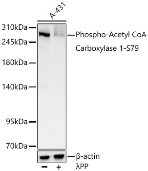 Western blot analysis of lysates from A-431 cells using Phospho-Acetyl CoA Carboxylase 1-S79 Rabbit mAb at 1:1000 dilution. A-431 cells were treated by λpp at 37℃ for 1 hour.|Secondary antibody: HRP-conjugated Goat anti-Rabbit IgG (H+L) at 1:10000 dilution.|Lysates/proteins: 25 μg per lane.|Blocking buffer: 3% nonfat dry milk in TBST.|Detection: ECL Basic Kit.|Exposure time: 60s.