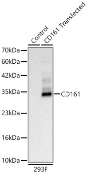 Western blot analysis of lysates from wild type (WT) and 293F cells transfected with CD161 using CD161 Rabbit mAb at 1:3000 dilution. |Secondary antibody: HRP-conjugated Goat anti-Rabbit IgG (H+L) at 1:10000 dilution.|Lysates/proteins: 30 μg per lane.|Blocking buffer: 3% nonfat dry milk in TBST.|Detection: ECL Basic Kit.|Exposure time: 0.5s.