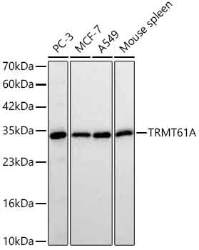 Western blot analysis of various lysates using TRMT61A Rabbit mAb (A25353) at 1:3000 dilution incubated overnight at 4℃.| Secondary antibody: HRP-conjugated Goat anti-Rabbit IgG (H+L) (AS014) at 1:10000 dilution.| Lysates / proteins: 25 μg per lane.| Blocking buffer: 3 % nonfat dry milk in TBST.| Detection: ECL Basic Kit (RM00020).| Exposure time: 30s.