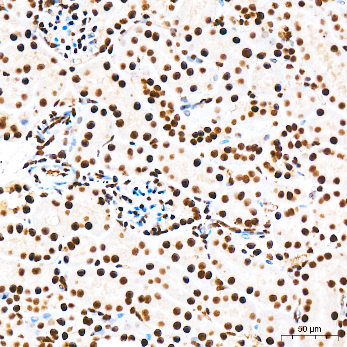 Immunohistochemistry analysis of paraffin-embedded Mouse kidney tissue using Phospho-TIFA-T9 Rabbit mAb at a dilution of 1:400 (40x lens). High pressure antigen retrieval was performed with 0.01 M citrate buffer (pH 6.0) prior to IHC staining.