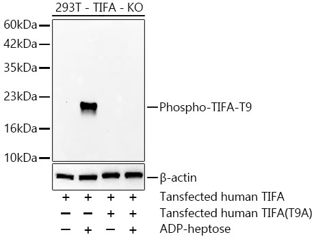 Western blot analysis of lysates from TIFA knockout (KO) 293T cells transfected with TIFA or mutational TIFA, using Phospho-TIFA-T9 Rabbit mAb at 1:5000 dilution incubated overnight at 4°C. Human TIFA-transfected TIFA KO 293T cells were treated with ADP-heptose.|Secondary antibody: HRP-conjugated Goat anti-Rabbit IgG (H+L) at 1:10000 dilution.|Lysates/proteins: 25 μg per lane.|Blocking buffer: 3% nonfat dry milk in TBST.|Detection: ECL Basic Kit.|Exposure time: 45s.|WB samples for antibody validation are kindly provided by Dr. Feng Shao, NIBS