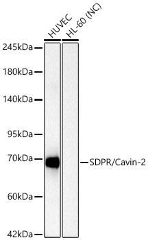 Western blot analysis of various lysates using SDPR/Cavin-2 Rabbit mAb at 1:1000 dilution.|Secondary antibody: HRP-conjugated Goat anti-Rabbit IgG (H+L) at 1:10000 dilution.|Lysates/proteins: 25 μg per lane.|Blocking buffer: 3% nonfat dry milk in TBST.|Detection: ECL Basic Kit.|Negative control (NC): HL-60.|Exposure time: 10s.