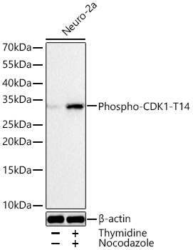 Western blot analysis of lysates from Neuro-2a cells using Phospho-CDK1-T14 Rabbit mAb at 1:3000 dilution incubated at room temperature for 1.5 hours. Neuro-2a cells were treated with Thymidine (2 nM)  for 16 hours and Nocodazoleat (100 ng/mL) at 37℃ for 24 hours.|Secondary antibody: HRP-conjugated Goat anti-Rabbit IgG (H+L) at 1:10000 dilution.|Lysates/proteins: 30 μg per lane.| Blocking buffer: 3 % nonfat dry milk in TBST.| Detection: ECL Basic Kit.| Exposure time: 90 s.