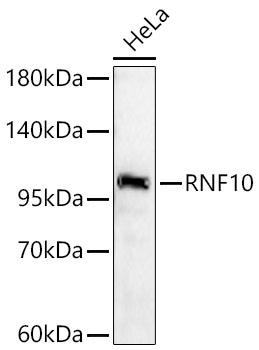 Western blot analysis of HeLa cells using RNF10 Rabbit mAb at 1:2000 dilution.|Secondary antibody: HRP-conjugated Goat anti-Rabbit IgG (H+L) at 1:10000 dilution.|Lysates/proteins: 25 μg per lane.|Blocking buffer: 3% nonfat dry milk in TBST.|Detection: ECL Basic Kit.|Exposure time:60s.