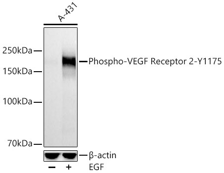 Western blot analysis of lysates from A-431 cells using Phospho-VEGF Receptor 2-Y1175 Rabbit mAb at 1:3900 dilution incubated overnight at 4℃. A-431 cells were treated by EGF (50 ng/ml) at 37℃ for 30 minutes after serum-starvation overnight. | Secondary antibody: HRP-conjugated Goat anti-Rabbit IgG (H+L) at 1:10000 dilution.|Lysates/proteins: 30 μg per lane.| Blocking buffer: 3 % nonfat dry milk in TBST.| Detection: ECL Basic Kit.| Exposure time: 1s.