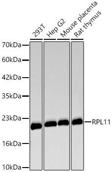 Western blot analysis of various lysates using RPL11 Rabbit mAb at 1:3000 dilution incubated overnight at 4℃.|Secondary antibody: HRP-conjugated Goat anti-Rabbit IgG (H+L) at 1:10000 dilution. |Lysates/proteins: 25 μg per lane.|Blocking buffer: 3% nonfat dry milk in TBST.|Detection: ECL Basic Kit|Exposure time: 15 s.