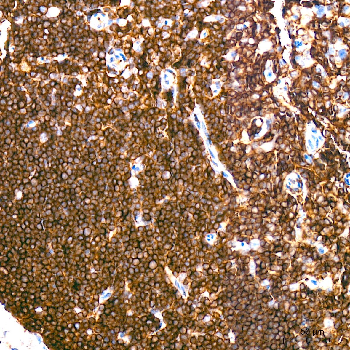 Immunohistochemistry analysis of paraffin-embedded Mouse spleen tissue using CD162/PSGL-1 Rabbit mAb at a dilution of 1:200 (40x lens). High pressure antigen retrieval performed with 0.01M Citrate buffer (pH 6.0) prior to IHC staining.