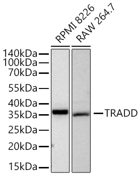 Western blot analysis of various lysates using [KD Validated] TRADD  Rabbit mAb (A27817) at 1:5000 dilution incubated overnight at 4℃.|Secondary antibody: HRP-conjugated Goat anti-Rabbit IgG (H+L) (AS014) at 1:10000 dilution.|Lysates/proteins: 25 μg per lane.|Blocking buffer: 3% nonfat dry milk in TBST.|Detection: ECL Basic Kit (RM00020).|Exposure time: 45s.