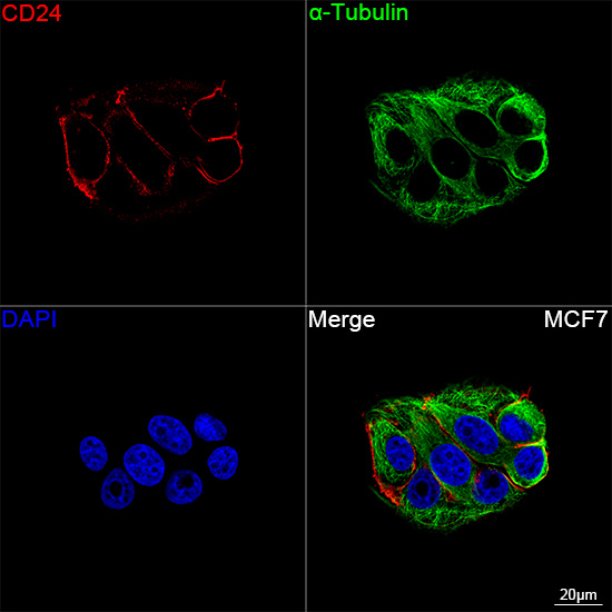 Confocal imaging of MCF7 cells using CD24 Rabbit mAb (A27097, dilution 1:200) followed by a further incubation with Cy3 Goat Anti-Rabbit IgG (H+L) (AS007, dilution 1:500) (Red). The cells were counterstained with α-Tubulin Mouse mAb (AC012, dilution 1:400) followed by incubation with ABflo® 488-conjugated Goat Anti-Mouse IgG (H+L) Ab (AS076, dilution 1:500) (Green). DAPI was used for nuclear staining (Blue). Objective: 100x.