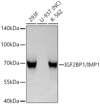 Western blot analysis of various lysates using IGF2BP1/IMP1 Rabbit mAb at 1:1000 dilution incubated at room temperature for 1.5 hours.|Secondary antibody: HRP-conjugated Goat anti-Rabbit IgG (H+L) at 1:10000 dilution.|Lysates/proteins: 25 μg per lane.|Blocking buffer: 3% nonfat dry milk in TBST.|Detection: ECL Basic Kit.|Negative control (NC): U-937|Exposure time: 1s.