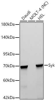 Western blot analysis of various lysates using Syk Rabbit mAb at 1:1000 dilution incubated overnight at 4℃.|Secondary antibody: HRP-conjugated Goat anti-Rabbit IgG (H+L) at 1:10000 dilution. |Lysates/proteins: 25 μg per lane.|Blocking buffer: 3% nonfat dry milk in TBST.|Detection: ECL Basic Kit|Negative control (NC): MOLT-4|Exposure time: 45s.