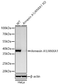 Western blot analysis of lysates from wild type (WT) and Annexin A1/ANXA1 knockdown (KD) HeLa cells using [KD Validated] Annexin A1/ANXA1 Rabbit mAb (A25918) at 1:50000 dilution incubated at room temperature for 1.5 hours.|Secondary antibody: HRP-conjugated Goat anti-Rabbit IgG (H+L) (AS014) at 1:10000 dilution.|Lysates/proteins: 25 μg per lane.|Blocking buffer: 3% nonfat dry milk in TBST.|Detection: ECL Basic Kit (RM00020).|Exposure time: 1s.